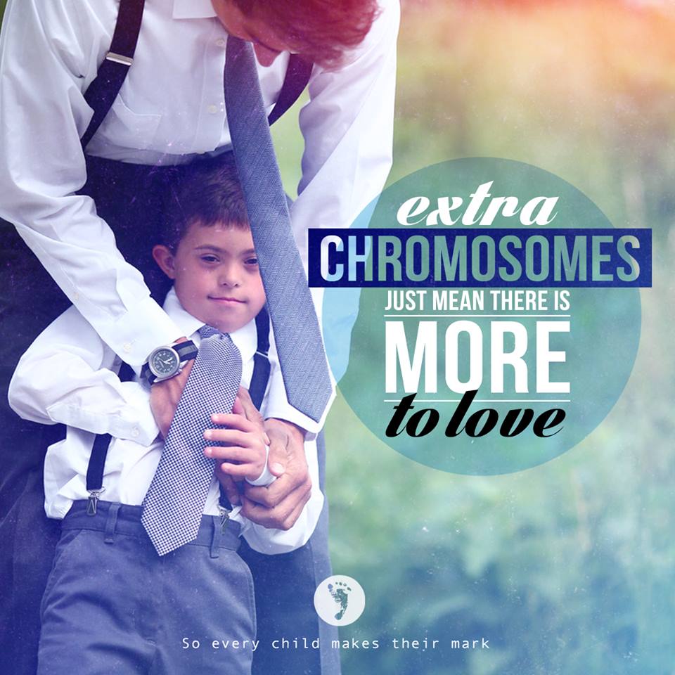 Extra Chromosomes Just Mean There Is More To Love