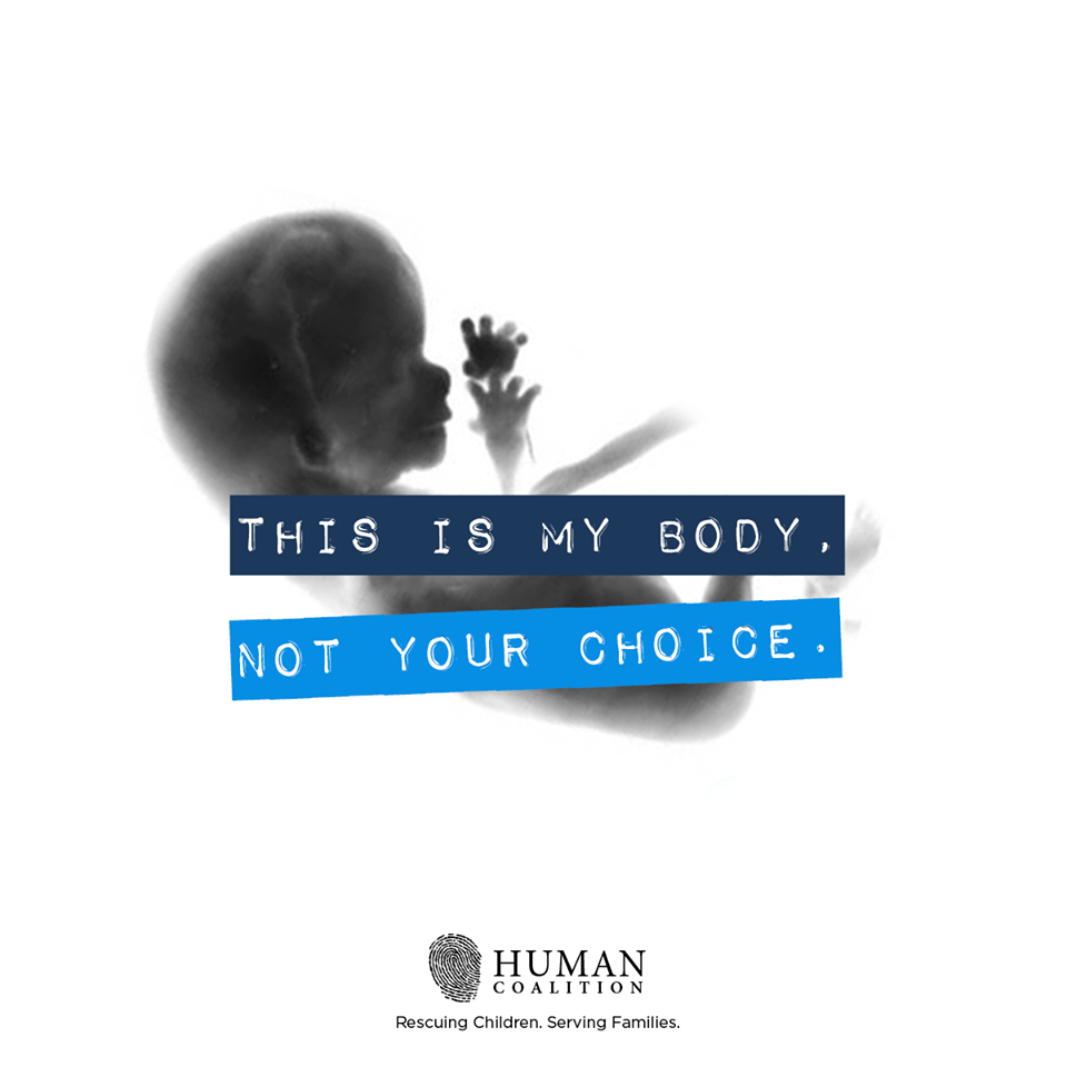 This is my body not your choice