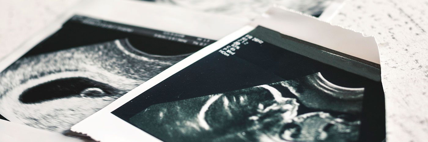 Abortion and the Church, Part 2: Our Calling to End Abortion is Urgent